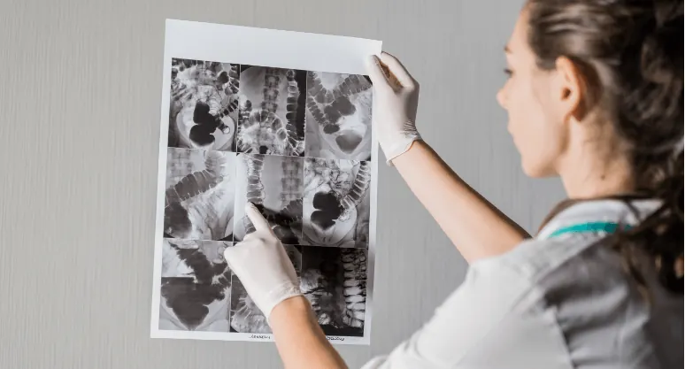 Radiologist reviewing a printed CT series